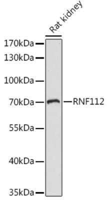 Western Blot: ZNF179 AntibodyAzide and BSA Free [NBP2-93335]